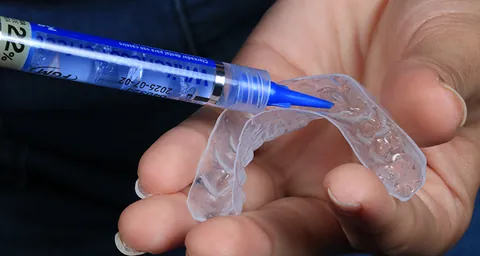 Gel clareador sendo colocado na moldeira com uma seringa.