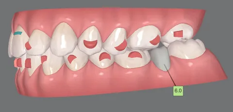 Os dentes vistos de lado, em 3D.