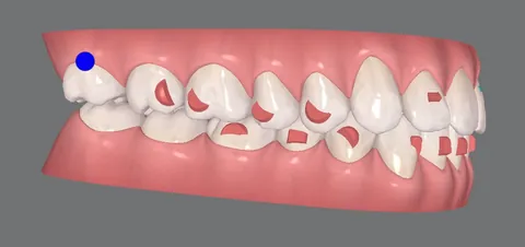 Os dentes vistos do outro lado.